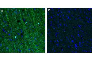 Free-floating frozen brain sections from a paraformaldehyde-perfused rat were incubated with Anti-CFTR Antibody (ABIN7043096, 1:300), followed by goat anti-rabbit secondary antibody conjugated to Alexa Fluor® 488 (green).