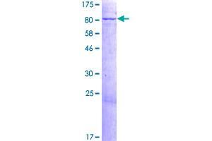 Image no. 1 for Kelch-Like 12 (Drosophila) (KLHL12) (AA 1-568) protein (GST tag) (ABIN1308796)
