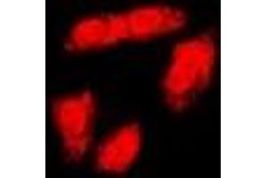 Immunofluorescent analysis of BRCA1 (pS1423) staining in HeLa cells.