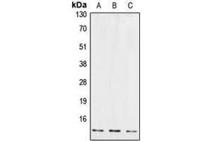Western blot analysis of Cystatin B expression in JAR (A), EOC20 (B), U87MG (C) whole cell lysates. (CSTB anticorps  (Center))