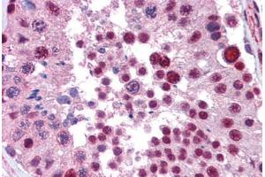 Human Testis (formalin-fixed, paraffin-embedded) stained with NKRF antibody ABIN462215 followed by biotinylated goat anti-rabbit IgG secondary antibody ABIN481713, alkaline phosphatase-streptavidin and chromogen.