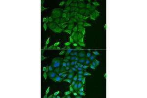 Immunofluorescence analysis of HeLa cells using CD84 antibody (ABIN6132251, ABIN6138235, ABIN6138236 and ABIN6222077).