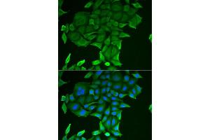Immunofluorescence analysis of HeLa cells using CD84 antibody (ABIN6132251, ABIN6138235, ABIN6138236 and ABIN6222077). (CD84 anticorps  (AA 22-225))