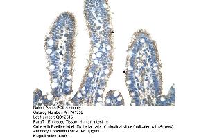 Rabbit Anti-APCS Antibody  Paraffin Embedded Tissue: Human Intestine Cellular Data: Epithelial cells of intestinal villas Antibody Concentration: 4. (APCS anticorps  (N-Term))