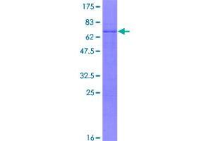 Image no. 1 for Paired-Like Homeodomain 1 (PITX1) (AA 1-314) protein (GST tag) (ABIN1315179)