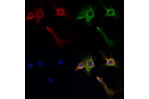 ABIN6260516 and ABIN6267035 staining HepG2 by IF/ICC. (CBP anticorps  (C-Term))
