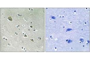 Immunohistochemistry analysis of paraffin-embedded human brain, using PAK1 (Phospho-Ser204) Antibody. (PAK1 anticorps  (pSer204))