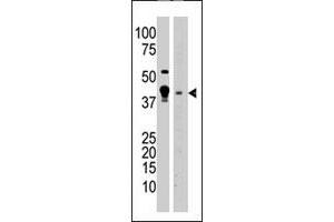 The MBD2 polyclonal antibody  is used in Western blot to detect MBD2 in A-375 cell lysate (lane 1) and mouse brain tissue lysate (lane 2) lysate. (MBD2 anticorps  (N-Term))