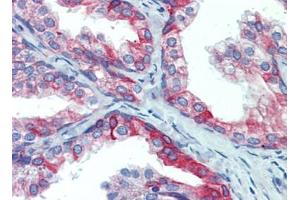 Prostate, Human: Formalin-Fixed, Paraffin-Embedded (FFPE) (PDIA4 anticorps  (AA 623-638))
