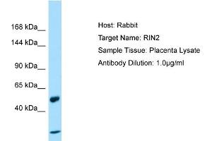 Host: Rabbit Target Name: RIN2 Sample Type: Placenta lysates Antibody Dilution: 1. (RIN2 anticorps  (N-Term))