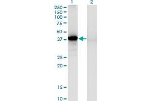 Western Blot analysis of SORD expression in transfected 293T cell line by SORD monoclonal antibody (M03), clone 1C2. (SORD anticorps  (AA 1-357))