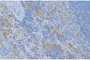 ABIN6277012 at 1/100 staining Human lymph node tissue by IHC-P. (CDA anticorps  (Internal Region))