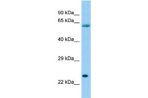Host: Rabbit Target Name: SPCS3 Sample Type: THP-1 Whole Cell lysates Antibody Dilution: 1. (SPCS3 anticorps  (Middle Region))