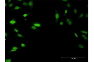 Immunofluorescence of purified MaxPab antibody to SIRT7 on HeLa cell. (SIRT7 anticorps  (AA 1-400))