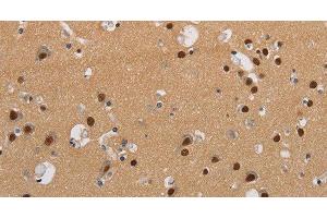 Immunohistochemistry of paraffin-embedded Human brain using KCNG4 Polyclonal Antibody at dilution of 1:40 (KCNG4 anticorps)