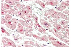 Rabbit Anti-DLST antibody Catalog Number: ARP61476 Formalin Fixed Paraffin Embedded Tissue: Human Heart Primary antibody Concentration: 1:200 Secondary Antibody: Donkey anti-Rabbit-Cy3 Secondary Antibody Concentration: 1:200 Magnification: 20x Exposure Time: 0.