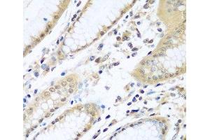 Immunohistochemistry of paraffin-embedded Human stomach using WDR48 Polyclonal Antibody at dilution of 1:100 (40x lens). (WDR48 anticorps)