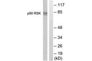 Western blot analysis of extracts from 293 cells, treated with PMA 125ng/ml 30', using p90 RSK (Ab-359/363) Antibody. (RPS6KA3 anticorps  (AA 331-380))