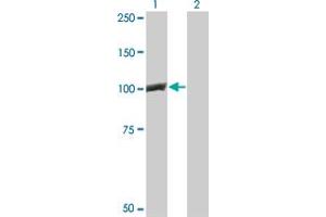 Western Blot analysis of CTNNB1 expression in transfected 293T cell line by CTNNB1 monoclonal antibody (M02), clone 1C9.