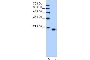 WB Suggested Anti-PEBP1 Antibody Titration:  1. (PEBP1 anticorps  (C-Term))