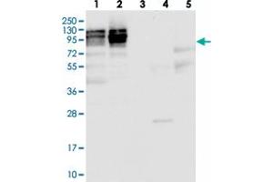Western blot analysis of Lane 1: RT-4, Lane 2: U-251 MG, Lane 3: Human Plasma, Lane 4: Liver, Lane 5: Tonsil with NOP2 polyclonal antibody  at 1:100-1:250 dilution. (Nucleolar Protein 1 (NOL1) anticorps)