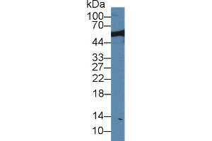 Western blot analysis of Rat Serum, using Rat NUP50 Antibody (1 µg/ml) and HRP-conjugated Goat Anti-Rabbit antibody ( (NUP50 anticorps  (AA 179-428))