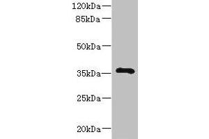 Western blot All lanes: GIMAP7 antibody at 2 μg/mL + Jurkat whole cell lysate Secondary Goat polyclonal to rabbit IgG at 1/10000 dilution Predicted band size: 35 kDa Observed band size: 35 kDa (GIMAP7 anticorps  (AA 1-273))