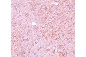 Immunohistochemical staining of rat brain tissue with PIAS4 polyclonal antibody  at 5 ug/mL dilution. (PIAS4 anticorps  (N-Term))