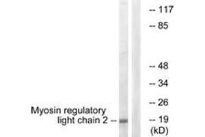 Western blot analysis of extracts from COLO205 cells, using MRLC2 (Ab-18) Antibody. (MYL12B anticorps  (AA 3-52))