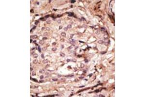 Image no. 2 for anti-Glial Fibrillary Acidic Protein (GFAP) (N-Term) antibody (ABIN357395) (GFAP anticorps  (N-Term))