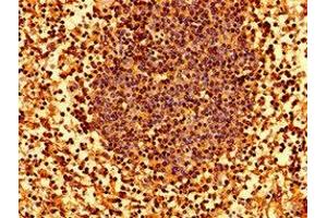 Immunohistochemistry of paraffin-embedded human lymph node tissue using ABIN7155571 at dilution of 1:100 (HLA-C anticorps  (AA 62-306))