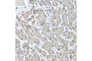 Immunohistochemistry of paraffin-embedded human liver injury using ALKBH4 antibody at dilution of 1:100 (x40 lens). (ALKBH4 anticorps)