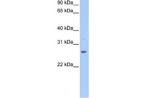 WB Suggested Anti-CRISP1 Antibody Titration: 0. (CRISP1 anticorps  (N-Term))