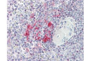 IHC-P Image LITAF antibody [N1C3] detects LITAF protein at cytoplasm on human placenta by immunohistochemical analysis.