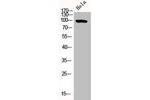 Western Blot analysis of HELA cells using Phospho-PKD2 (S876) Polyclonal Antibody