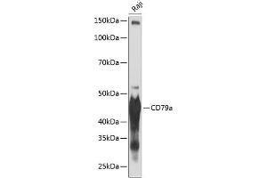 Western blot analysis of extracts of Raji cells, using CD79a antibody (ABIN7265805) at 1:1000 dilution.
