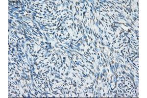 Immunohistochemical staining of paraffin-embedded Carcinoma of thyroid tissue using anti-PORmouse monoclonal antibody. (POR anticorps)