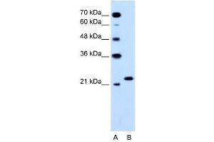 RAB14 antibody (70R-10565) used at 1. (RAB14 anticorps  (C-Term))