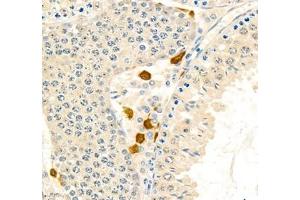 Immunohistochemistry of paraffin embedded mouse testis using BIRC3 (ABIN7073179) at dilution of 1: 1800 (400x lens)