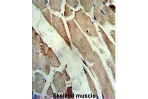 Immunohistochemistry (IHC) image for anti-Creatine Kinase, Muscle (CKM) antibody (ABIN3002974)