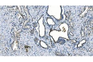 IHC analysis of Carbonic Anhydrase I/CA1 using anti-Carbonic Anhydrase I/CA1 antibody (ABIN7602621). (CA1 anticorps  (AA 9-261))
