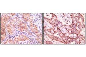 Immunohistochemistry (IHC) image for anti-Synuclein, gamma (Breast Cancer-Specific Protein 1) (SNCG) antibody (ABIN1845097) (SNCG anticorps)