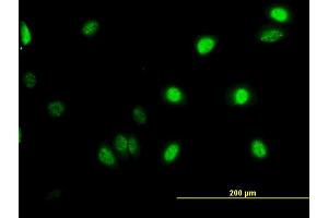 Immunofluorescence of monoclonal antibody to GABPA on HeLa cell.