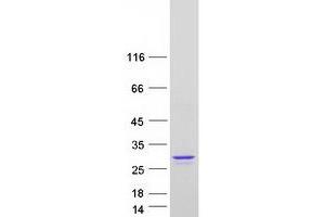 Validation with Western Blot