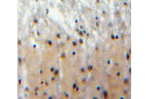 Used in DAB staining on fromalin fixed paraffin-embedded brain tissue