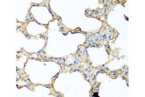 Immunohistochemistry of paraffin-embedded Mouse lung using PIP Polyclonal Antibody at dilution of 1:100 (40x lens).