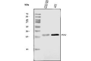 Western blot analysis of PLP2 using anti-PLP2 antibody (ABIN7600320).