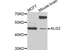 Western blot analysis of extracts of MCF7 and mouse brain cells, using ALG2 antibody.