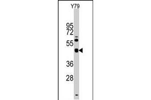 Western blot analysis of TGIF1 polyclonal antibody  in Y-79 cell line lysates (35 ug/lane). (TGIF1 anticorps  (Internal Region))