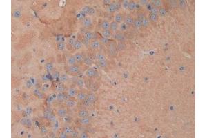 Detection of DNM1 in Mouse Brain Tissue using Polyclonal Antibody to Dynamin 1 (DNM1) (Dynamin 1 anticorps  (AA 572-745))